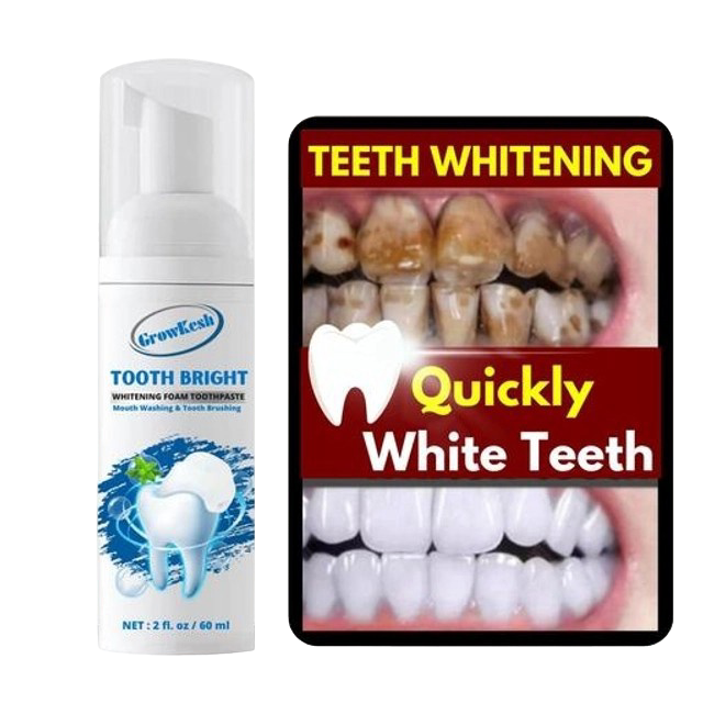 Teeth Whitening